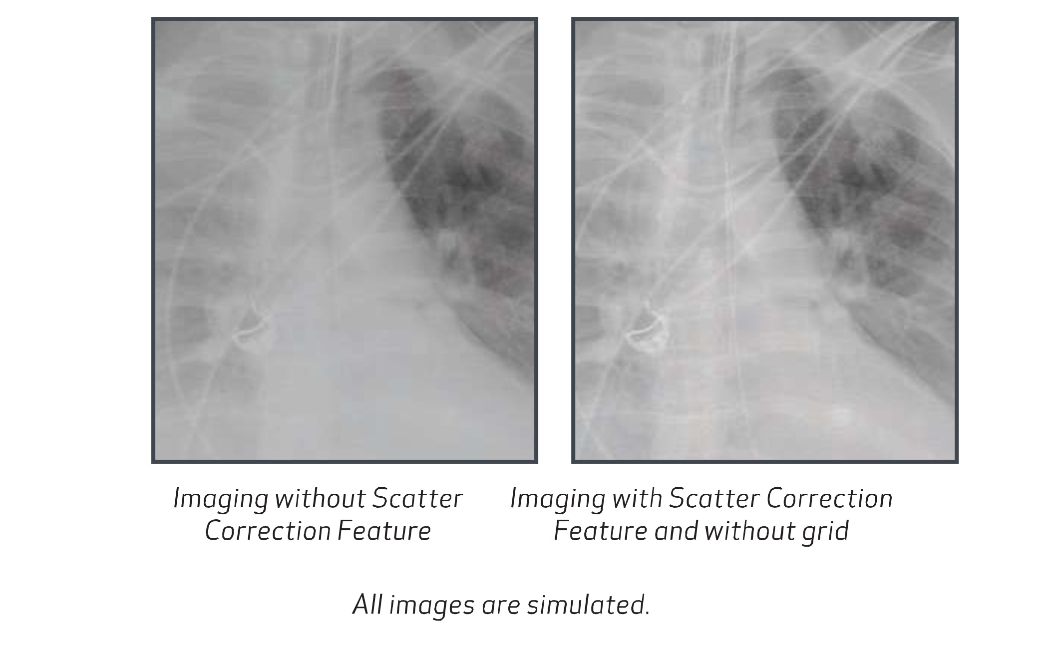 Scatter Correction | Sharp Imaging Solutions LLC