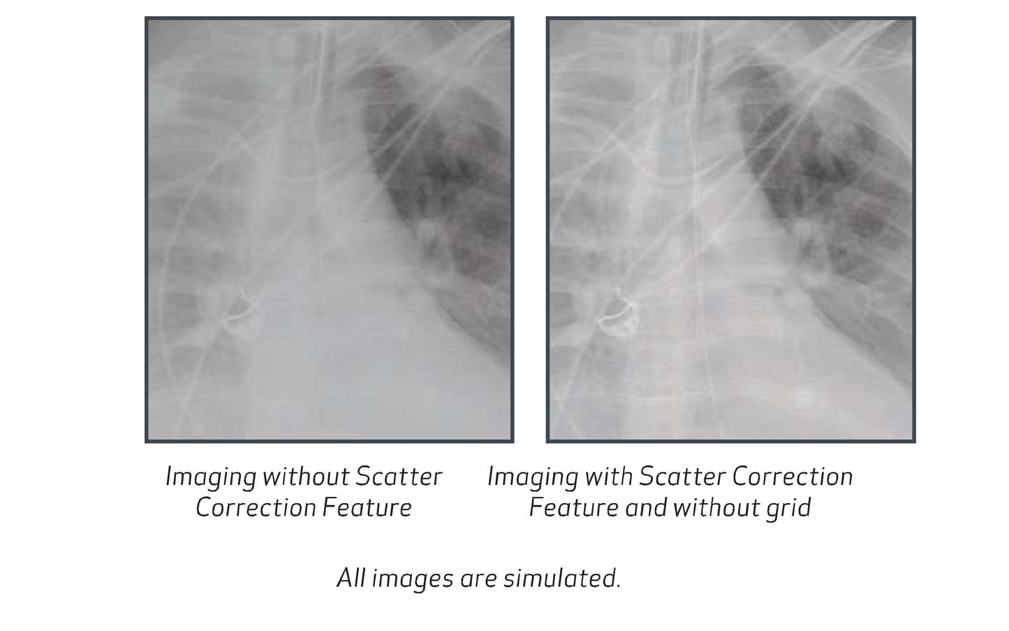 Scatter Correction