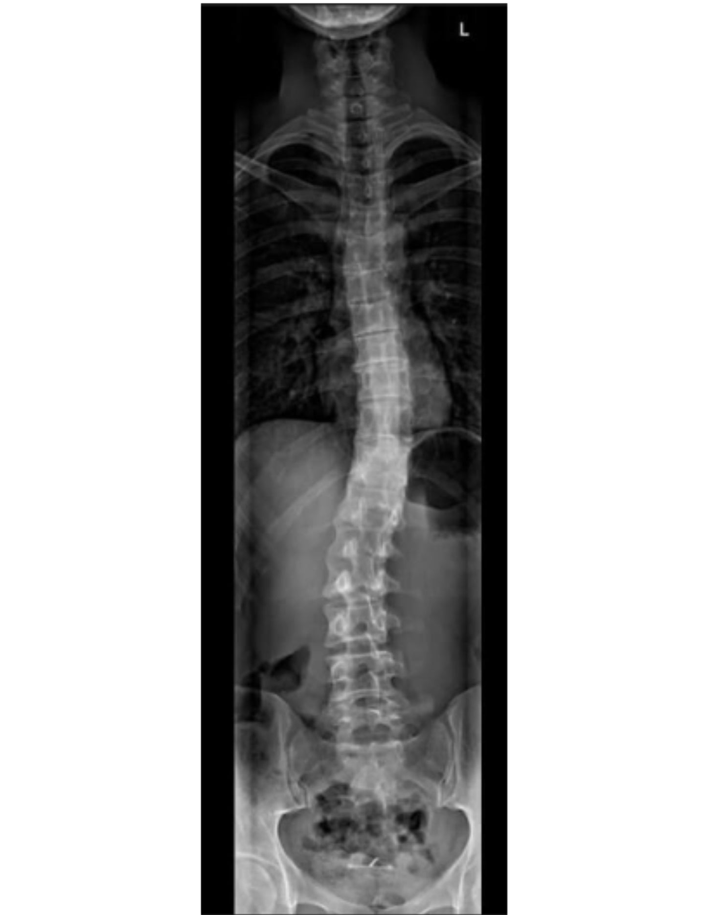 One Shot LL for CXDI series