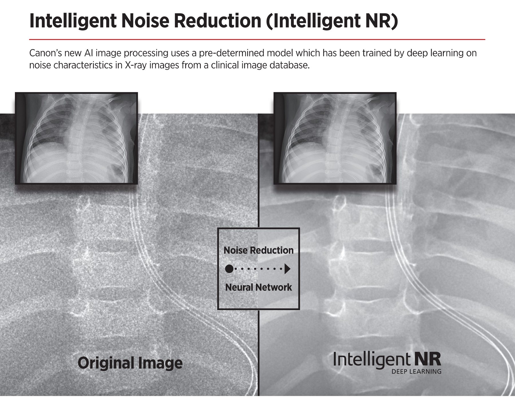 Canon Intelligent NR
