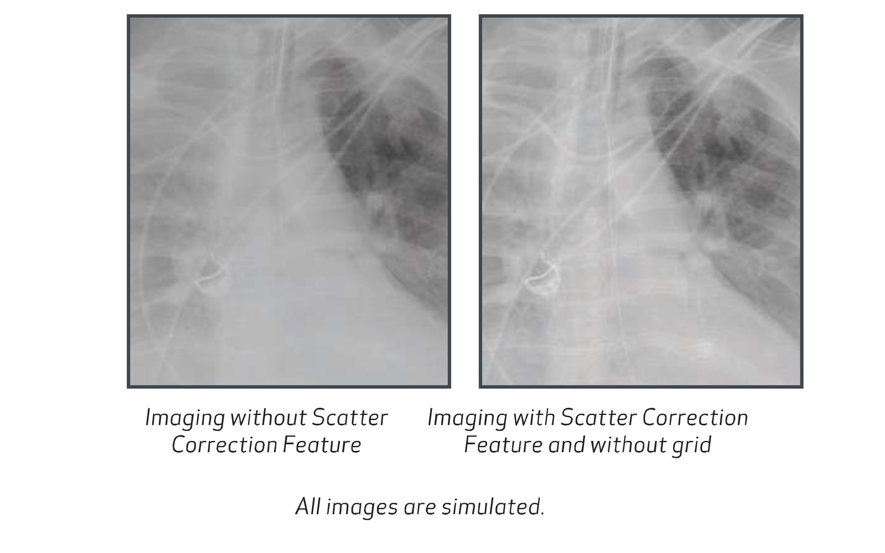 Canon Scatter Correction